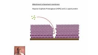 HPV dyskaryosis CIN abnormal smears and cervical cancer [upl. by Anirt368]