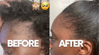 HOW I GREW MY EDGES BACK  HAIR JOURNEY EDGES [upl. by Ennyleuqcaj988]