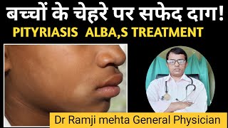 White Patch on Face  Is This Vitiligo or Pityriasis Alba बच्चों के चेहरे पर सफेद दागDr Ramji [upl. by Heida]