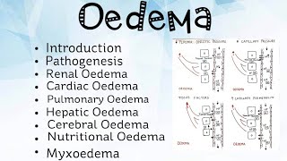 Oedema Pathology [upl. by Hamburger]