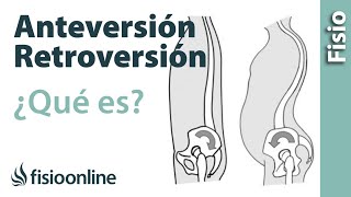 Anteversión y retroversión pélvicas  ¿Qué es [upl. by Ethe]