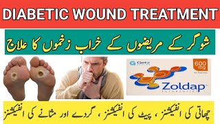 Zoldap 600mg Tablet Uses In Urdu hindi  Linezolid 600mg tablet review  zoldap tablet sideeffects [upl. by Bullard802]