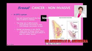 DUCTAL CARCINOMA IN SITU [upl. by Gentilis]