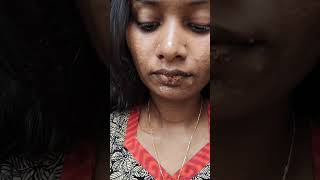 Lip Pigmentation ❌ How to get rid of dark lips malayalam lippigmentation lips homeremedies [upl. by Edina]