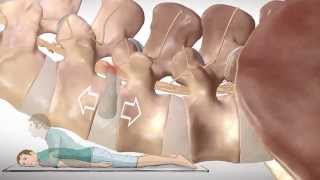 Chronic Low Back Pain  Understanding lower back structures and treatment approaches [upl. by Jeunesse392]