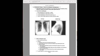 kettering A 19 to A 25 patient assessment radiographic imaging [upl. by Fabiolas]