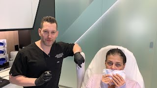 Female Facial Sculpting with Belotero  Smokers Lines and Lip Rejuvenation  West Hollywood CA [upl. by Giselle]