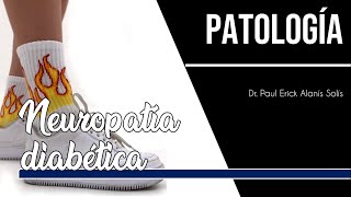 Neuropatía diabética periférica [upl. by Lerrad]