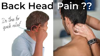 Instant Back Head Pain Relief सर के पीछे का दर्द का सटीक इलाज [upl. by Alrep]