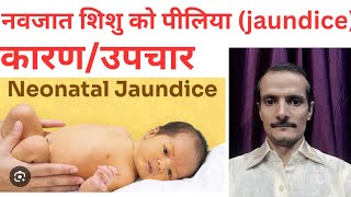 Neonatal jaundice navjat shishu ka jaundice Physiological jaundice [upl. by Esiuol156]