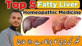 Fatty Liver Treatment  Fatty Liver Homeopathic Medicine  Top 5 Homeopathic Medicine [upl. by Anitrebla665]