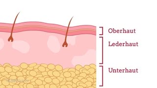 Wie entsteht Neurodermitis  NetDoktorde [upl. by Pleione]