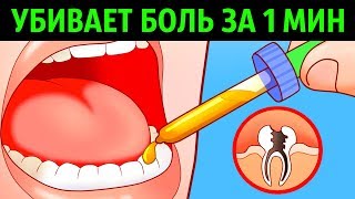 10 Способов Убить Зубную Боль за Минуту [upl. by Ennayr196]