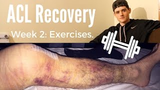 ACL exercises you need to be doing Post Surgery [upl. by Nhabois]