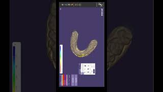 Exocad Veneer Design Tutorial  StepbyStep Digital Workflow for Perfect Smiles digitaldentistry [upl. by Borden]