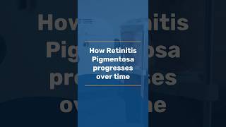 How RP progresses over time  Last stages of Retinitis Pigmentosa  RP treatment in India [upl. by Burra]