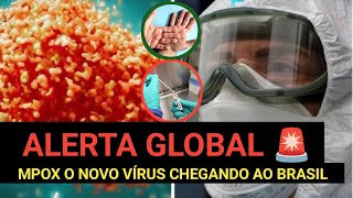 Mpox vírus que está chegando ao Brasil quot Sintomas e prevenção [upl. by Aggi]