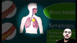 Lower Respiratory Infections Bronchitis Pneumonia Bronchiolitis [upl. by Marlie]