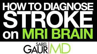 How to Diagnose Stroke on MRI Brain [upl. by Odraleba]