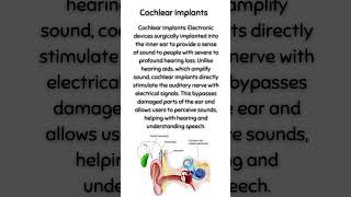 Cochlear Implants [upl. by Leanard833]