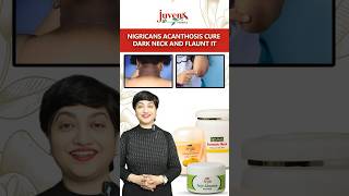 Nigricans Acanthosis Cure Dark Neck And Flaunt It  Juvena Herbals [upl. by Adnimra]