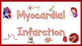 Myocardial InfarctionHeart Attack Causes Pathogenesis Signs amp Symptoms Diagnosis amp Treatment [upl. by Yengac]