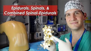 Epidural spinal and combined spinalepidural overview [upl. by Dal56]