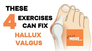 Hallux Valgus Exercises  no equipment  follow along  building up the arch of the foot [upl. by Egnalos]