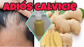 GOTERO DE JENGIBRE PARA CALVICIE Y CRECIMIENTO DEL CABELLO [upl. by Sabrina]