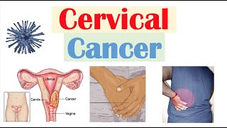 Cervical Cancer Risk Factors Pathophysiology Symptoms Staging Diagnosis Treatment amp Prevention [upl. by Intisar]