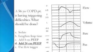 Problems in Mechanical Ventilation [upl. by Gregor983]