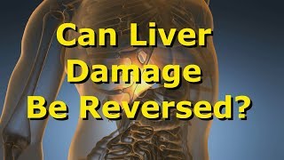 Can Liver Damage Be Reversed [upl. by Caldera]