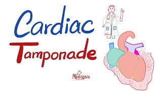 Cardiac Tamponade  Causes Symptoms Signs Diagnosis amp Treatment  Cardiology Series [upl. by Yesnyl577]