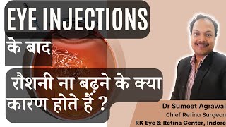 EYE INJECTION के बाद क्या रौशनी नहीं बढ़ी  जानिये इसके कारण [upl. by Ttennaej]