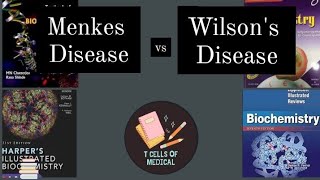 MENKES DISEASE vs Wilsons disease  Minerals ECM [upl. by Denman557]