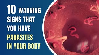 Dont Ignore These Early Symptoms of Parasites In Your Body [upl. by Boyden]