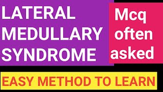 Lateral Medullary syndrome  MCQ amp mneumonic [upl. by Sualocin]