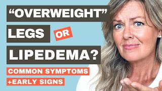 Common Symptoms and Signs of Lipedema Legs Feeling Weird Watch This [upl. by Gnanmos819]