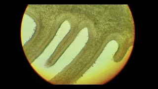 Fungal Microscopy How to get decent gill sections in agarics and more [upl. by Aeslehs914]