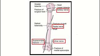 Humerus fracture nerve injury MRCS question solve CRACK MRCS [upl. by Jerrie492]