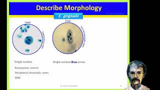 Diagnostic Parasitology Entamoeba gingivalis Naeflaria fowleri Balamuthia and Acanthamoeba [upl. by Ttoile615]