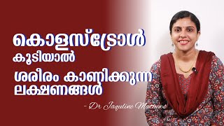 High cholesterol symptoms  കൊളസ്ട്രോൾ കൂടിയാൽ  ലക്ഷണങ്ങൾ  Dr Jaquline Mathews BAMS [upl. by Manus]