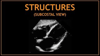 Cardiac STRUCTURES Subcostal views Echocardiography [upl. by Mclain949]