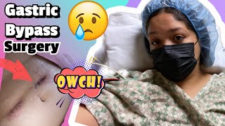 Bariatric SurgeryGastric Bypass I Finally did it [upl. by Notsla]