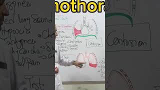 Hemothorax Pathalogy topnewstoday anatomy topbeats endocrineglands love topbeat humanbody [upl. by Ahsiele]