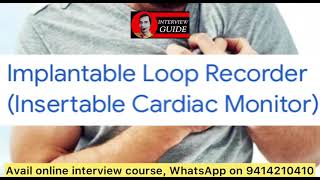 Implantable loop recorder  Insertable cardiac monitor  AMC Army Doctor Interview  Interview Guide [upl. by Aerehs]