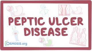 Peptic ulcer disease  causes symptoms diagnosis treatment pathology [upl. by Annehs]