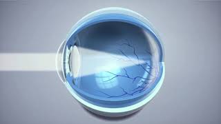 What is presbyopia  Optical Express [upl. by Milore]