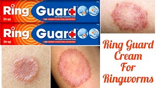 Ring Guard Cream for Ringworms [upl. by Trinatte8]