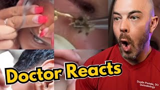 Dermatologists Reaction to Viral Pimple Popping Cyst Popping TikToks [upl. by Doble]